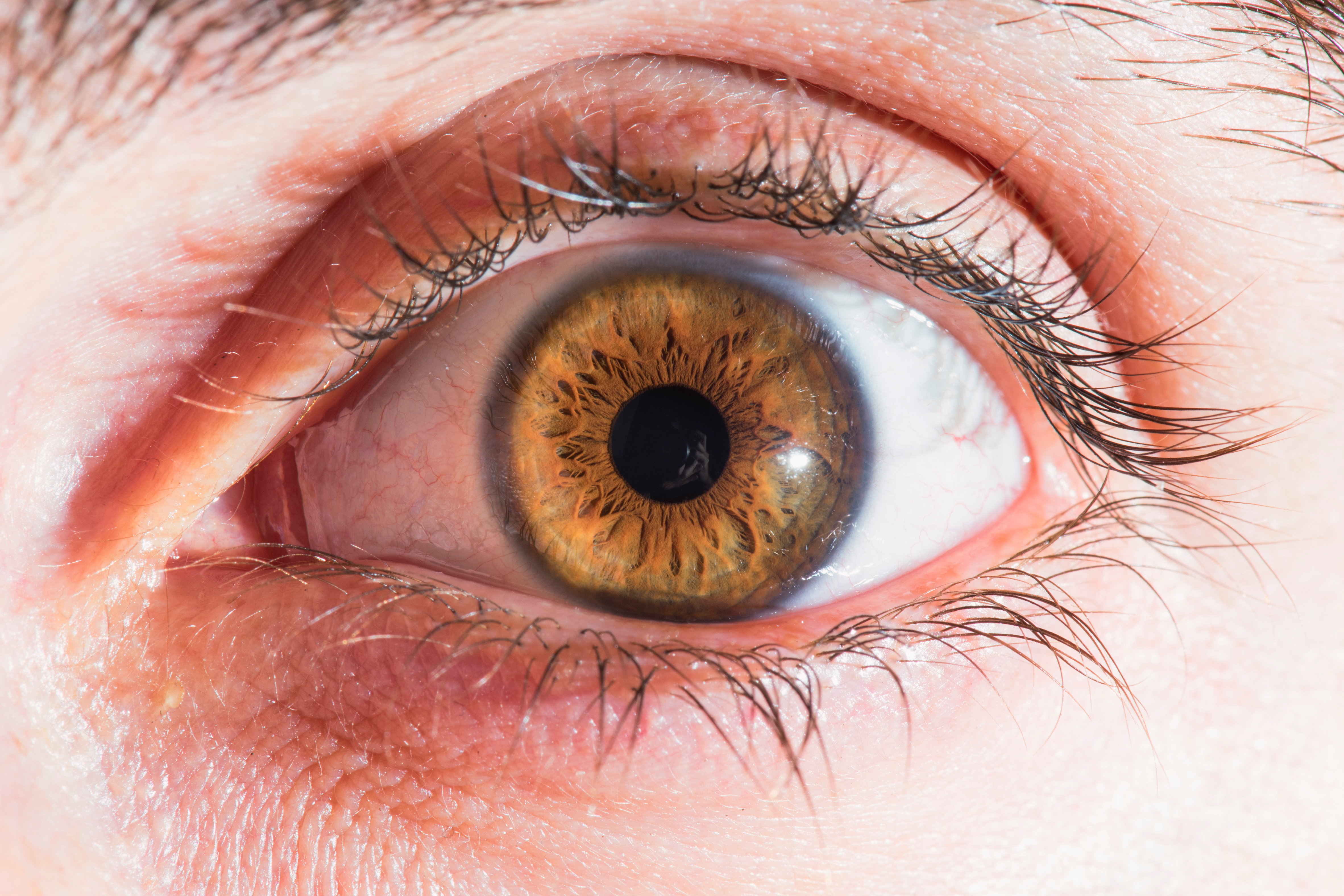 Image for French - Closer monitoring and treatment for diabetic retinopathy