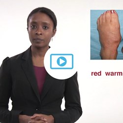 Image for Does my foot wound need urgent attention?