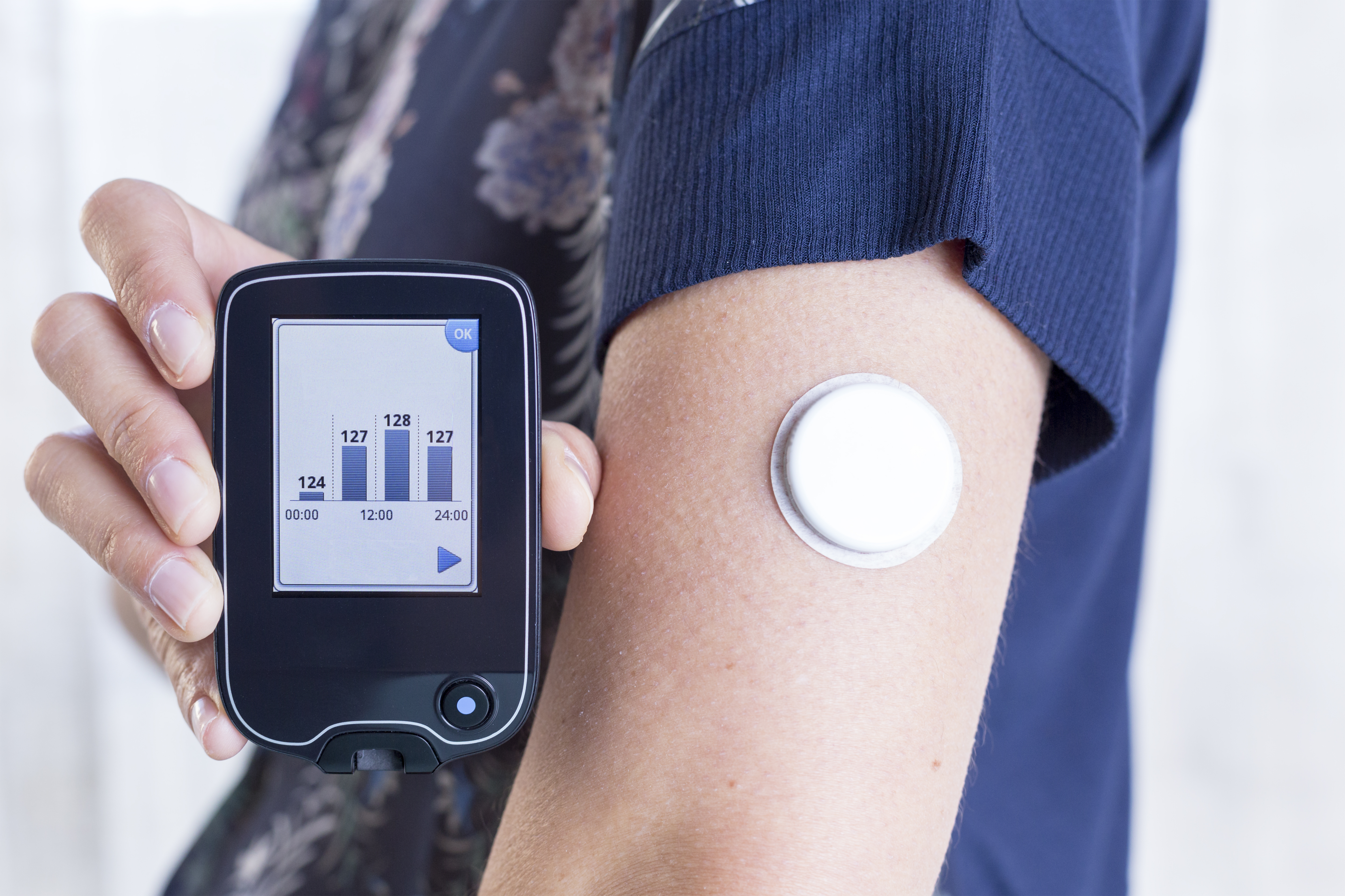 Image for Using Continuous Glucose Monitoring (CGM) to Improve Control in Type 1 Diabetes
