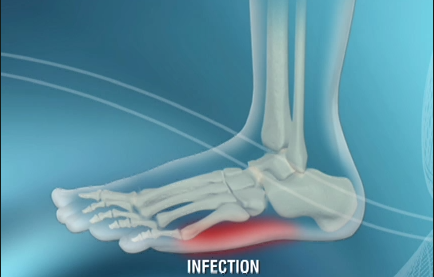 Image for Diabetes Footcare