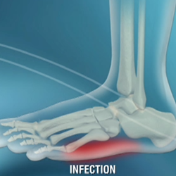 Image for Diabetes Footcare